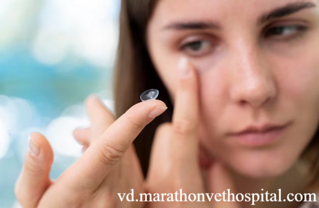 6 Aturan Pakai Softlens Saat Cuaca Panas agar Mata Tetap Sehat
