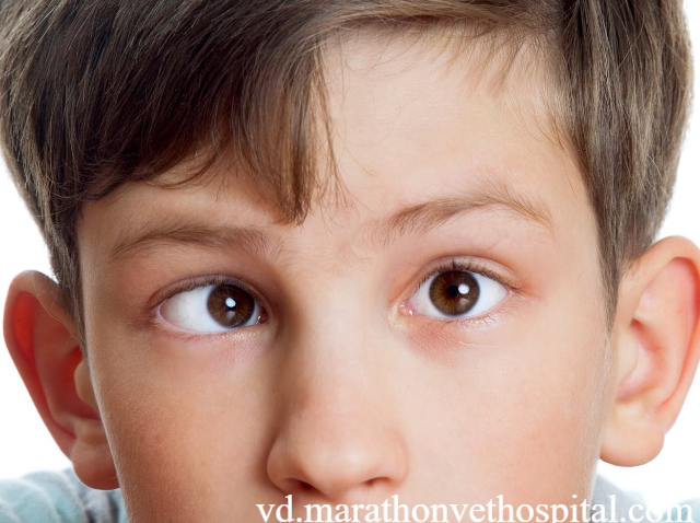 Jenis Pemeriksaan Mata untuk Mata Juling